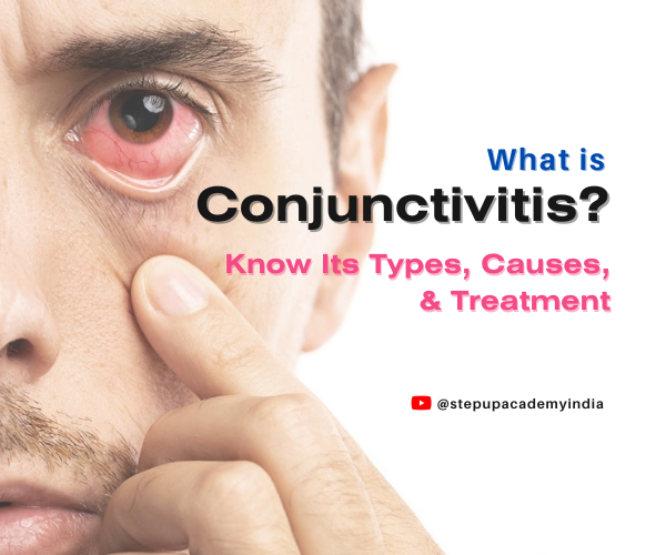 what-is-conjunctivitis-know-its-types-causes-and-treatment